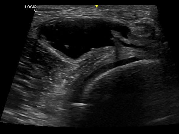 Por qué me duele la rodilla